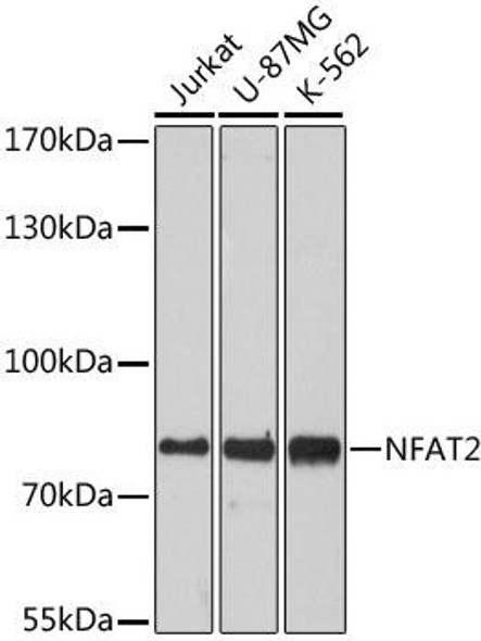 Epigenetics and Nuclear Signaling Antibodies 2 Anti-NFAT2 Antibody CAB1539