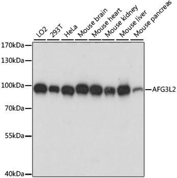 Cell Biology Antibodies 6 Anti-AFG3L2 Antibody CAB15393