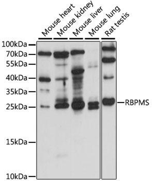 Epigenetics and Nuclear Signaling Antibodies 2 Anti-RBPMS Antibody CAB15395