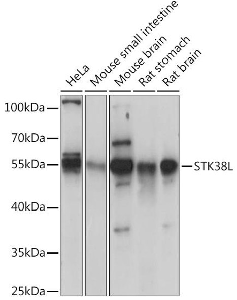 Signal Transduction Antibodies 2 Anti-STK38L Antibody CAB15406