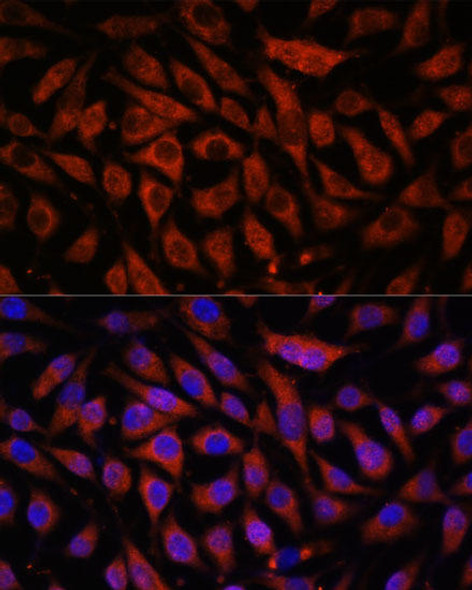 Signal Transduction Antibodies 2 Anti-STK38L Antibody CAB15406