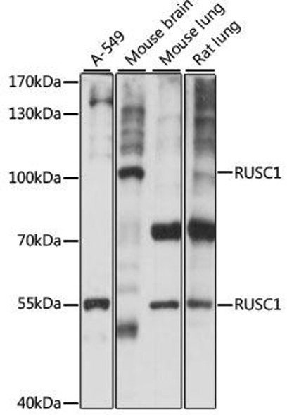 Signal Transduction Antibodies 2 Anti-RUSC1 Antibody CAB15417