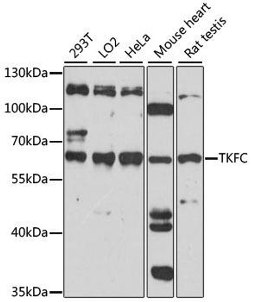 Cell Biology Antibodies 6 Anti-TKFC Antibody CAB15421