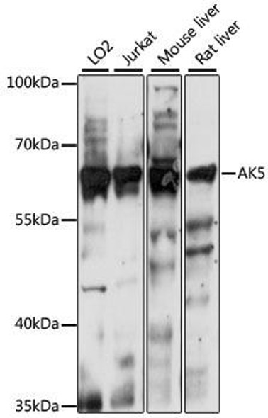 Signal Transduction Antibodies 2 Anti-AK5 Antibody CAB15424