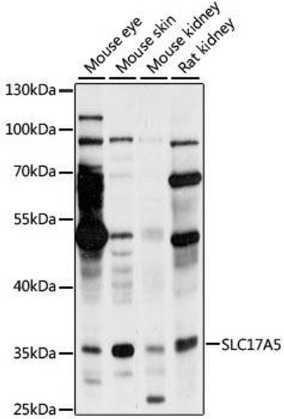 Signal Transduction Antibodies 2 Anti-SLC17A5 Antibody CAB15426