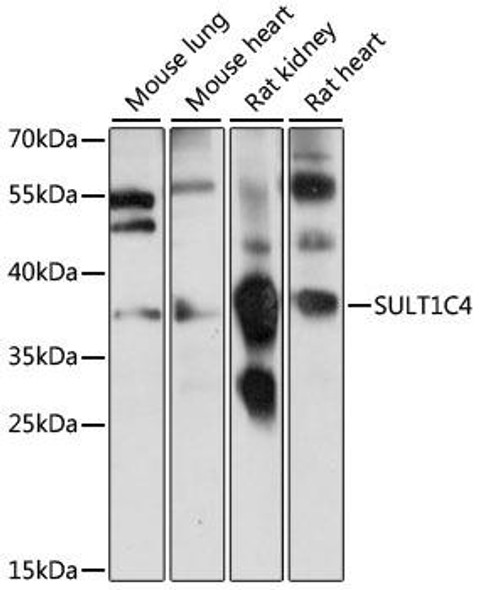 Cell Biology Antibodies 6 Anti-SULT1C4 Antibody CAB15432