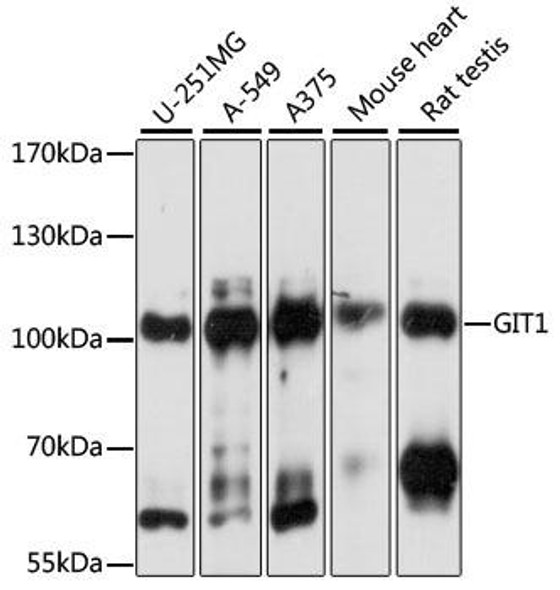 KO Validated Antibodies 1 Anti-GIT1 Antibody CAB15437KO Validated