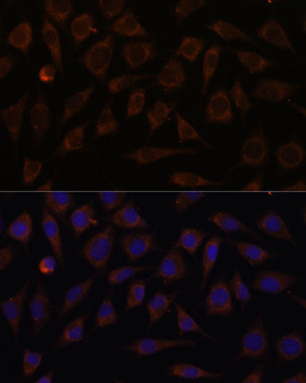 Cell Biology Antibodies 6 Anti-VILL Antibody CAB15440