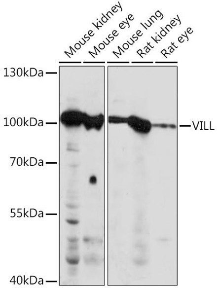 Cell Biology Antibodies 6 Anti-VILL Antibody CAB15440