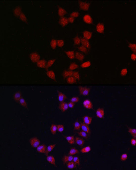 Cell Cycle Antibodies 1 Anti-ANAPC11 Antibody CAB15449