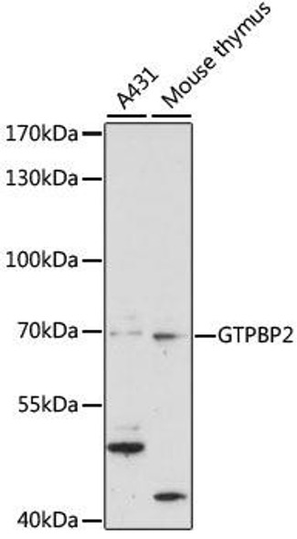 Cell Biology Antibodies 6 Anti-GTPBP2 Antibody CAB15457