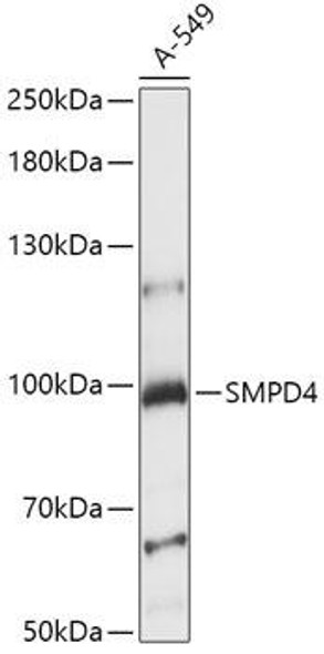 Cell Biology Antibodies 6 Anti-SMPD4 Antibody CAB15473