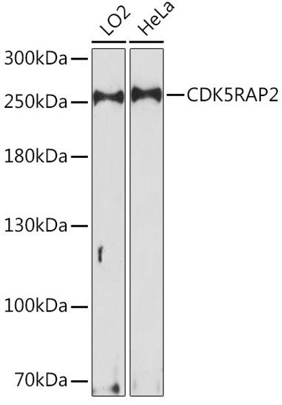 Cell Biology Antibodies 6 Anti-CDK5RAP2 Antibody CAB15476