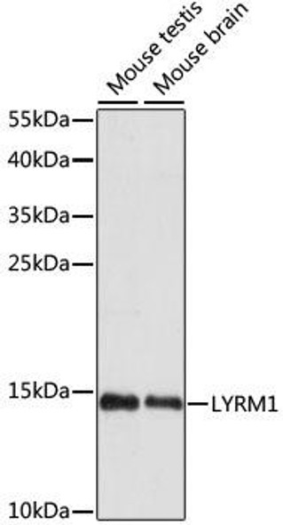 Signal Transduction Antibodies 2 Anti-LYRM1 Antibody CAB15483