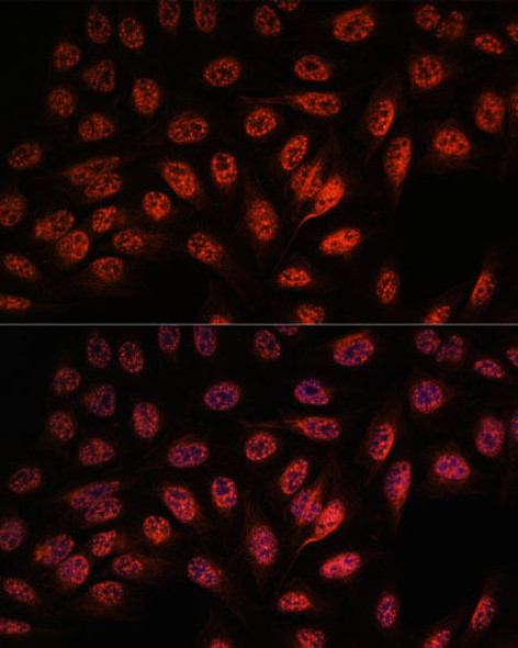 Epigenetics and Nuclear Signaling Antibodies 2 Anti-RBM25 Antibody CAB15496