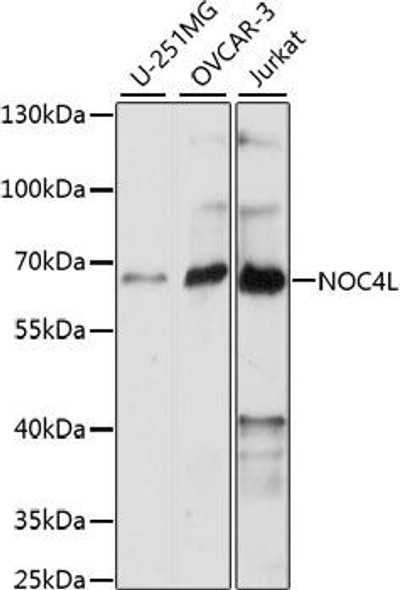 Cell Biology Antibodies 6 Anti-NOC4L Antibody CAB15509