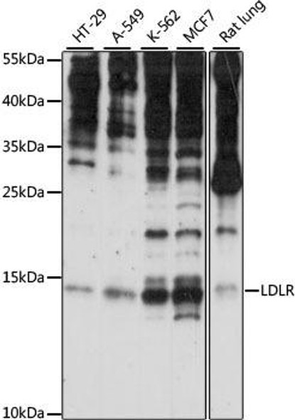 Epigenetics and Nuclear Signaling Antibodies 2 Anti-SNRNP25 Antibody CAB15511