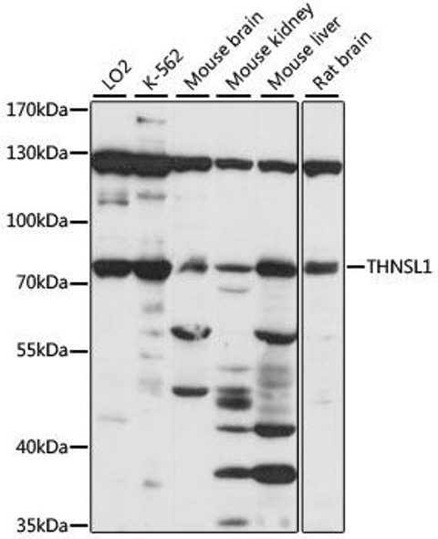 Cell Biology Antibodies 6 Anti-THNSL1 Antibody CAB15515