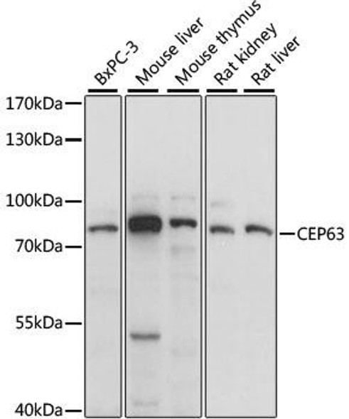 Cell Cycle Antibodies 1 Anti-CEP63 Antibody CAB15516
