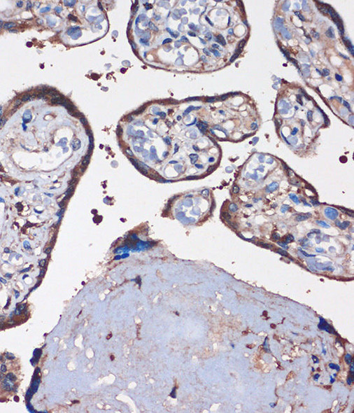 Epigenetics and Nuclear Signaling Antibodies 2 Anti-WDR61 Antibody CAB15520