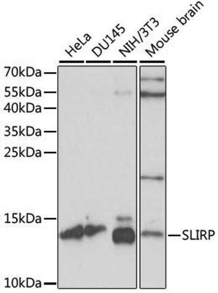 Epigenetics and Nuclear Signaling Antibodies 2 Anti-SLIRP Antibody CAB15524