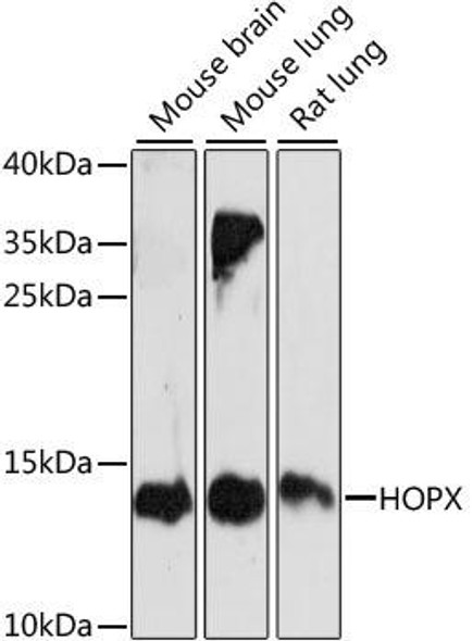 Epigenetics and Nuclear Signaling Antibodies 2 Anti-HOPX Antibody CAB15537