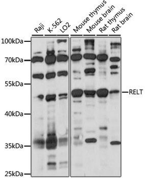 Cell Death Antibodies 1 Anti-RELT Antibody CAB15540