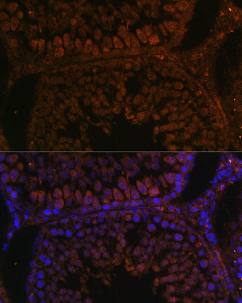 Cell Biology Antibodies 6 Anti-TPD52L3 Antibody CAB15544