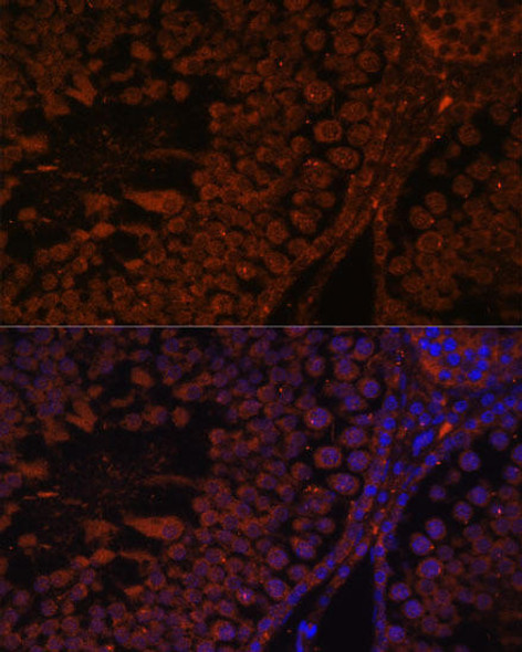 Cell Biology Antibodies 6 Anti-TPD52L3 Antibody CAB15545