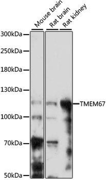 Cell Biology Antibodies 6 Anti-TMEM67 Antibody CAB15549