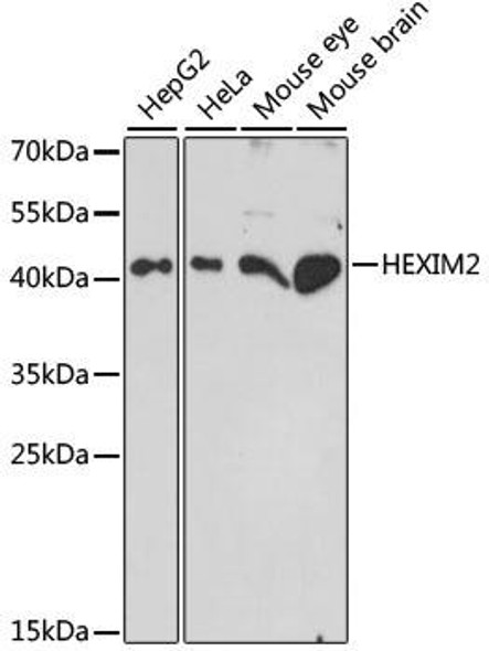 Epigenetics and Nuclear Signaling Antibodies 2 Anti-HEXIM2 Antibody CAB15565