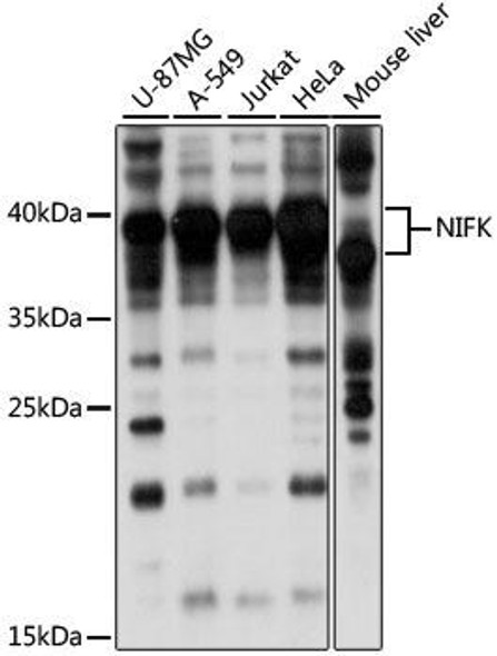 Cell Biology Antibodies 6 Anti-NIFK Antibody CAB15595