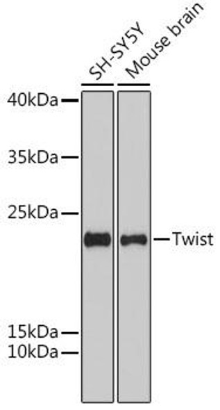 KO Validated Antibodies 1 Anti-Twist Antibody CAB15596KO Validated