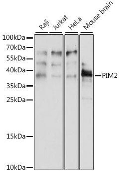 Cell Death Antibodies 1 Anti-PIM2 Antibody CAB15598
