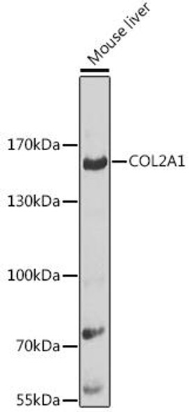 Cell Biology Antibodies 6 Anti-COL2A1 Antibody CAB1560