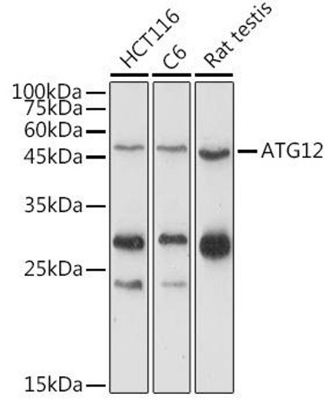 Autophagy Antibodies Anti-ATG12 Antibody CAB15609