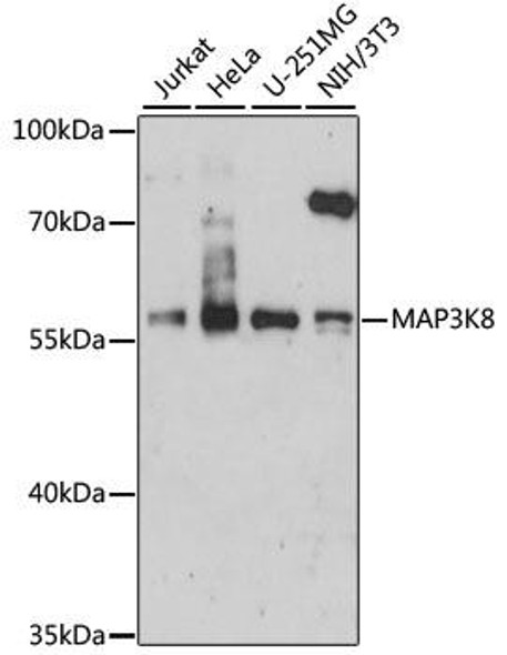 Cell Cycle Antibodies 1 Anti-MAP3K8 Antibody CAB15623