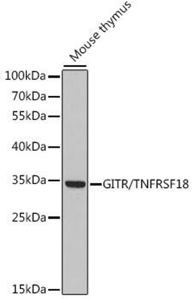Cell Death Antibodies 1 Anti-GITR/TNFRSF18 Antibody CAB15625