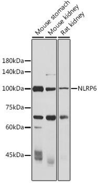 Immunology Antibodies 3 Anti-NLRP6 Antibody CAB15628