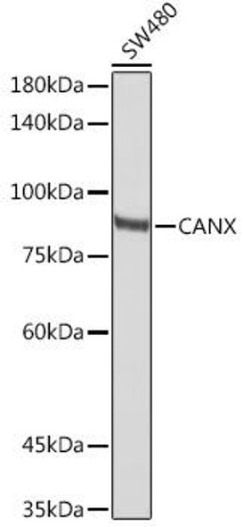 Immunology Antibodies 2 Anti-CANX Antibody CAB15631