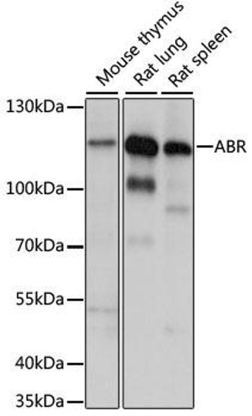 Signal Transduction Antibodies 2 Anti-ABR Antibody CAB15635