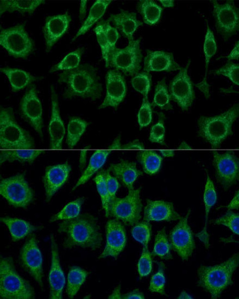 Cell Biology Antibodies 6 Anti-TSPO Antibody CAB15649