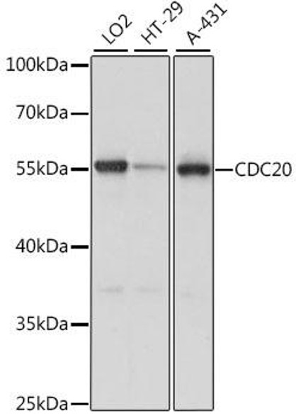 Cell Cycle Antibodies 1 Anti-CDC20 Antibody CAB15656