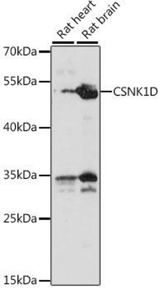 Cell Biology Antibodies 6 Anti-CSNK1D Antibody CAB15661