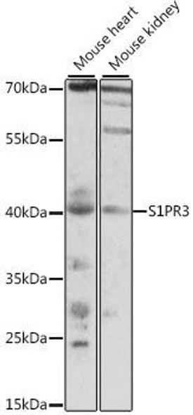 Signal Transduction Antibodies 2 Anti-S1PR3 Antibody CAB15664