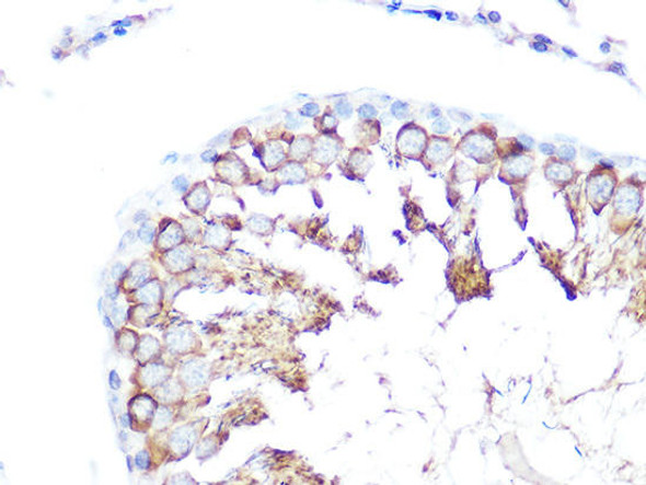 Signal Transduction Antibodies 2 Anti-FOLR1 Antibody CAB15672