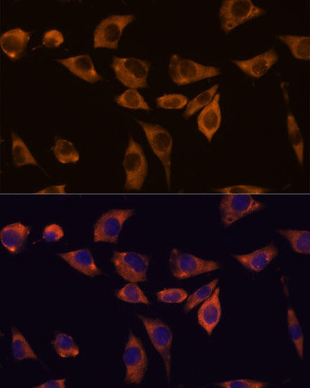 Immunology Antibodies 2 Anti-IL-10RB Antibody CAB15680