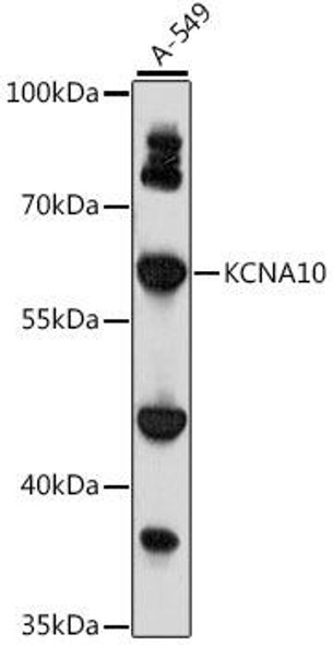 Signal Transduction Antibodies 2 Anti-KCNA10 Antibody CAB15681