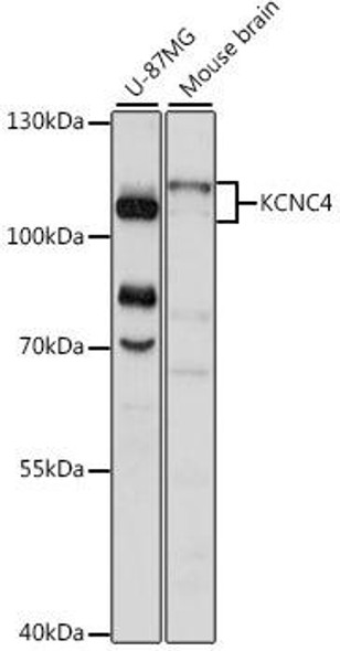 Signal Transduction Antibodies 2 Anti-KCNC4 Antibody CAB15682