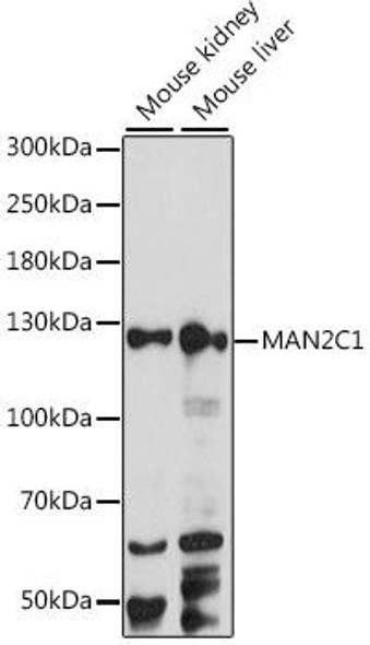 Signal Transduction Antibodies 2 Anti-MAN2C1 Antibody CAB15688